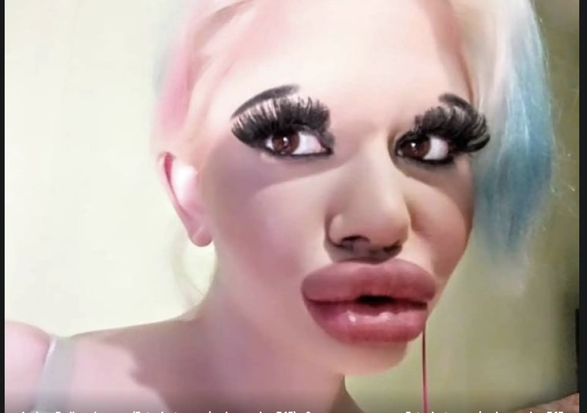 Potrošila više od 20 tisuća kuna na povećanje usana: 'Većinu negativnih komentara mi pišu žene'