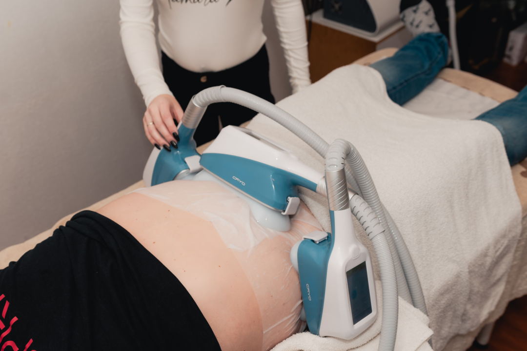 Pripremite se za ljeto uz promo cijene na zamrzavanje sala u Beauty Baru Tamara! 