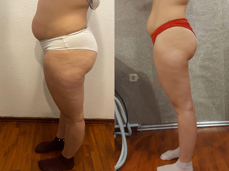 Iskoristite vrhunske popuste od čak 40 posto u Beauty Baru Tamara! 