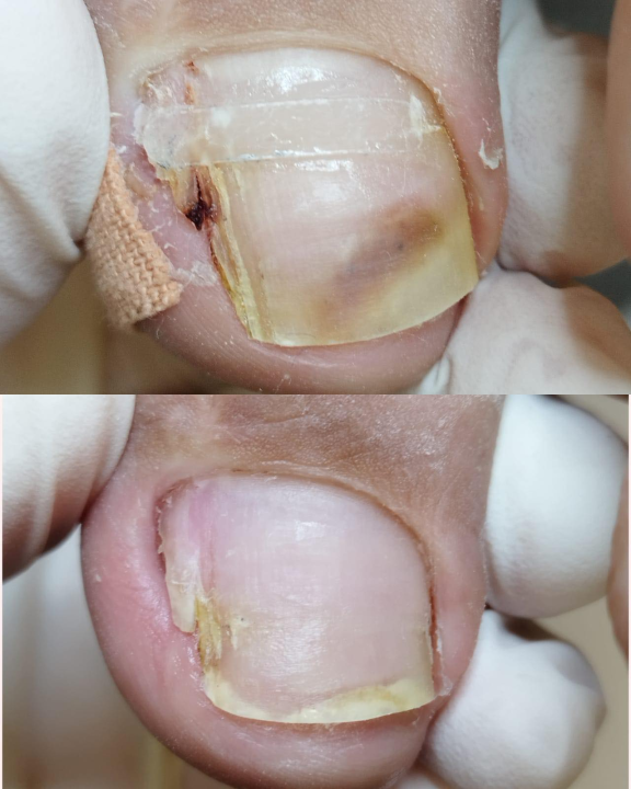 Pružite svojim stopalima maksimalnu njegu i riješite tegobe uz medicinsku pedikuru!