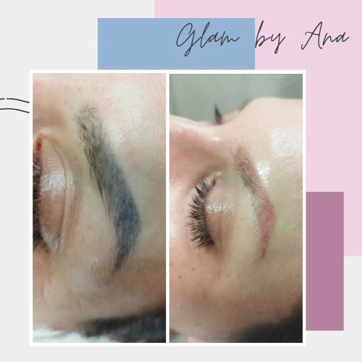 Uz Glam by Ana uklonite trajnu šminku i tetovaže bez boli!