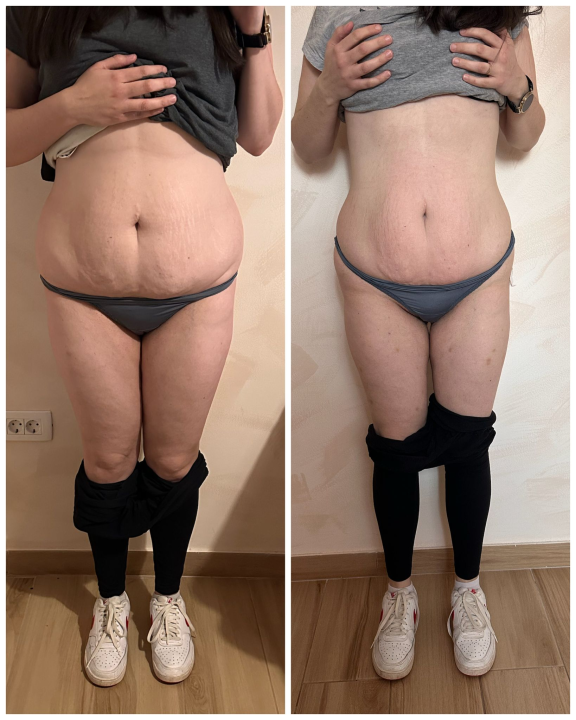 FOTO Skinite do 10 kilograma u 6 tjedana uz Beauty Clinic by Tamara