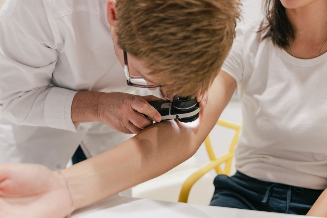 Dermatologinje upozoravaju: Prije ljeta obavezno pregledajte madeže