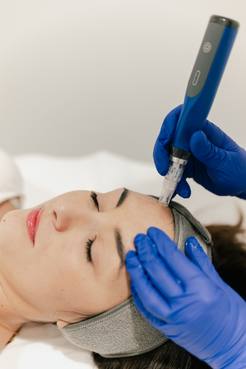 Dermatologinje upozoravaju: Prije ljeta obavezno pregledajte madeže