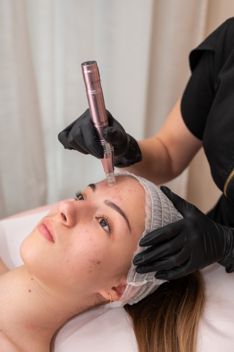 FOTO U Beauty Clinic by Tamara ljeto nije prepreka za lasersku epilaciju!