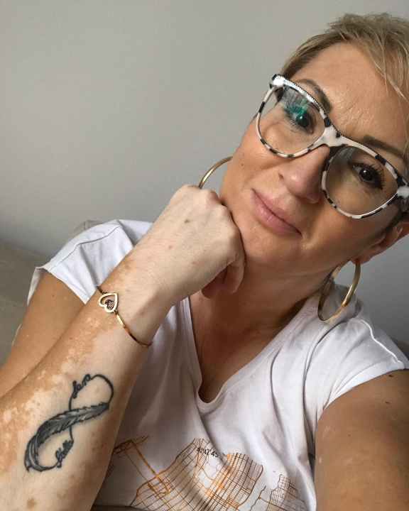 Kristini je moždani udar promijenio život, a njezin brend dođe joj kao terapija: 'Nije bilo svjetla, samo prekidač na off'