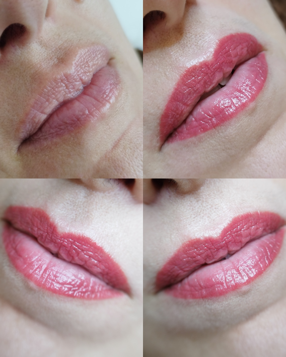 Pružite svojim stopalima maksimalnu njegu i riješite tegobe uz medicinsku pedikuru!