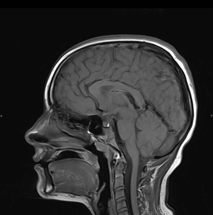 Naručite se na rendgen, ultrazvuk, CT ili MR u Poliklinici Affidea Vita