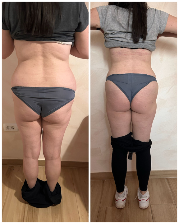 FOTO Skinite do 10 kilograma u 6 tjedana uz Beauty Clinic by Tamara