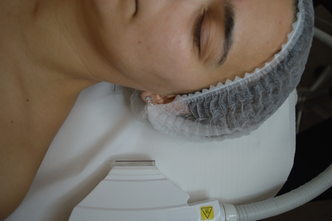 Iskoristite odličnu akciju i riješite se neželjenih dlačica u Be You salonu!