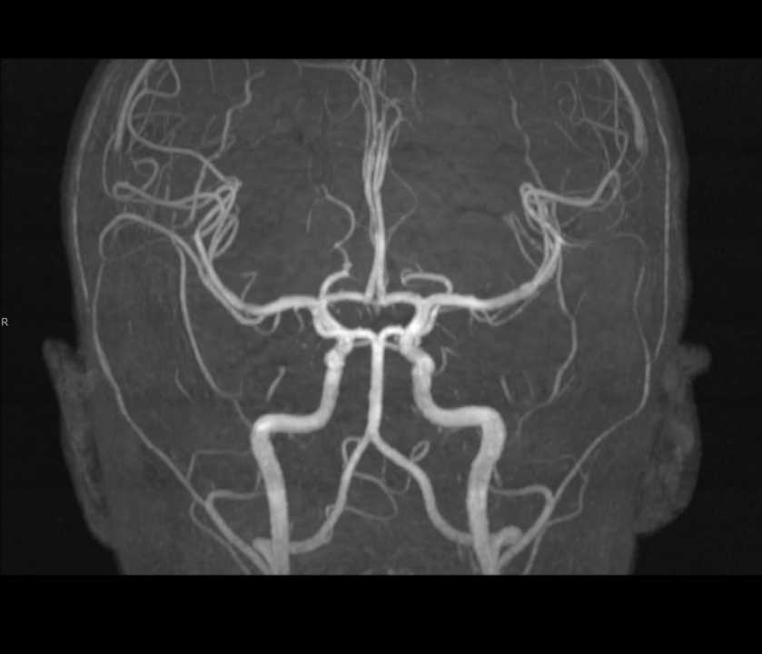 Tijekom Tjedna mozga Poliklinika Affidea Vita daje 20 posto popusta na magnetsku rezonancu!