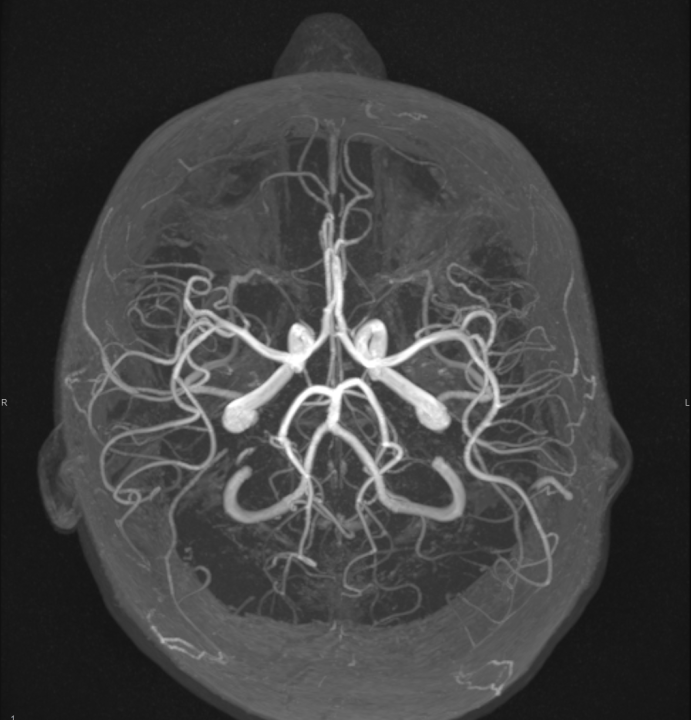 Naručite se na rendgen, ultrazvuk, CT ili MR u Poliklinici Affidea Vita