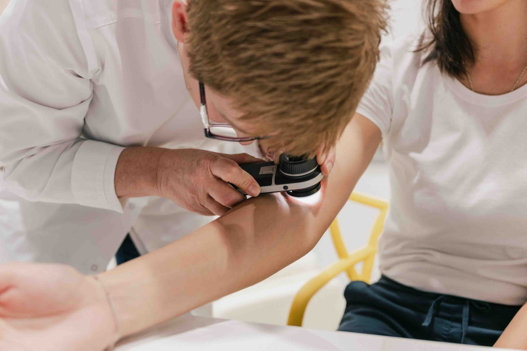 Obnovite svoju kožu vrhunskim dermatološkim tretmanima Poliklinike Krešimir