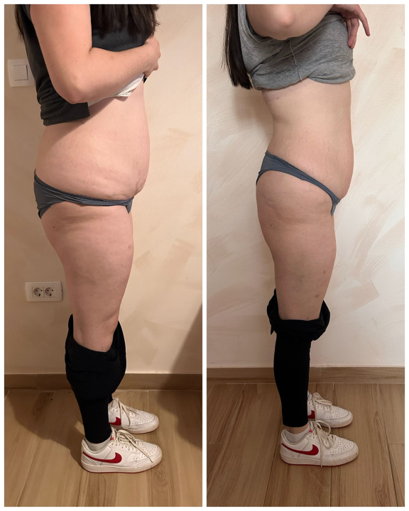 FOTO Skinite do 10 kilograma u 6 tjedana uz Beauty Clinic by Tamara