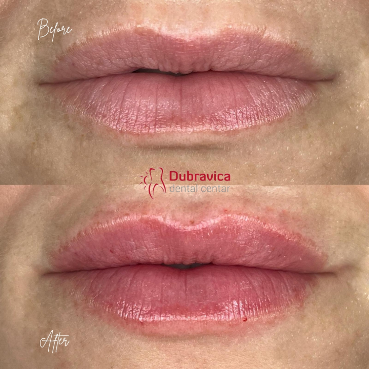 FOTO Dan žena u Dubravici: Iskoristite popust na najnovije trendove u estetskoj medicini 