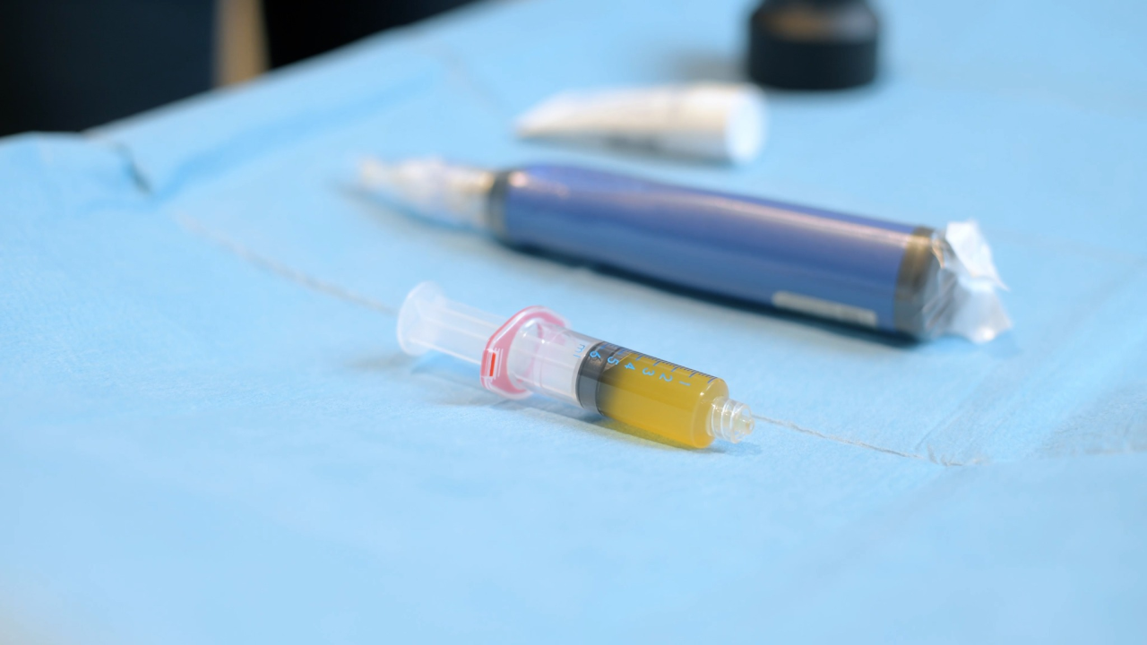 FOTO Sve traženiji PRP tretman sada i u Šibeniku: Evo o čemu je riječ!